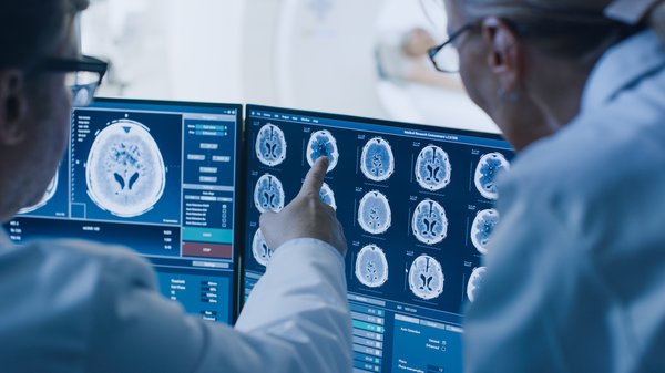 Doctors looking at scanned brain images.