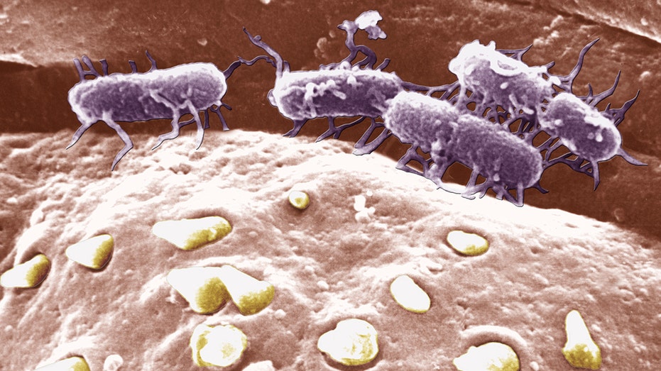 A scan of Salmonella.